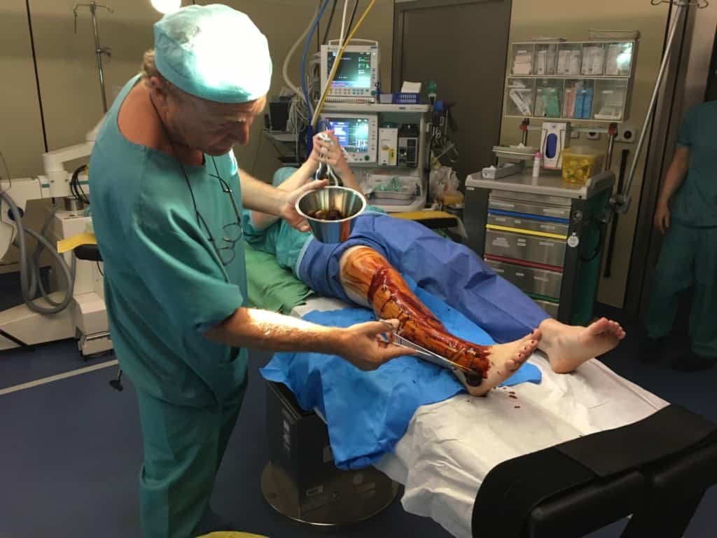 Salle d'opération où l'on voit un médecin soigner un patient qui saigne de la jambe.